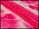 Muskelfasertypen und der Time Under Tension Test